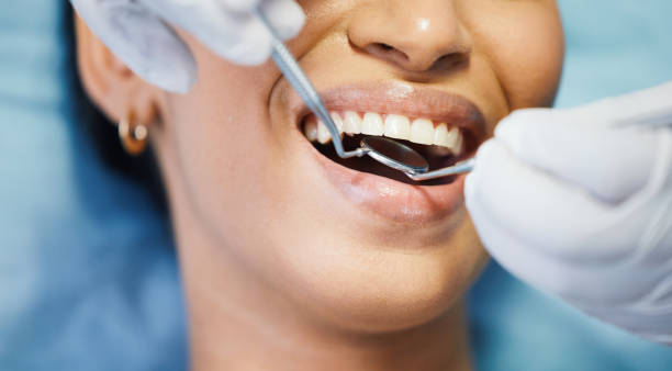 Best Emergency Root Canal Treatment in Wesley Chapel, NC