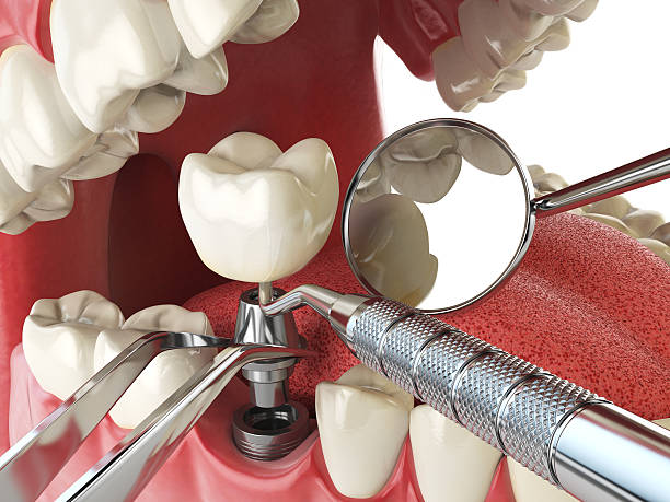 Best Mobile Emergency Dentist in Wesley Chapel, NC